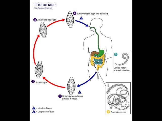 Morfologi Trichuris trichiura - Cacing Cambuk